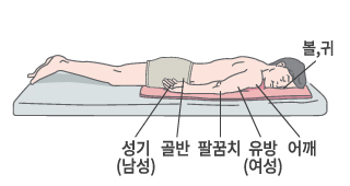볼, 귀, 어깨, 유방(여성), 팔꿈치, 골반, 성기(남성)